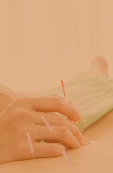 Acupuntura em Curitiba