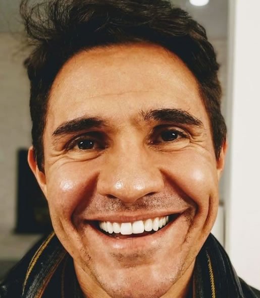 jefferson ferla especialista em acupuntura 515x591 1